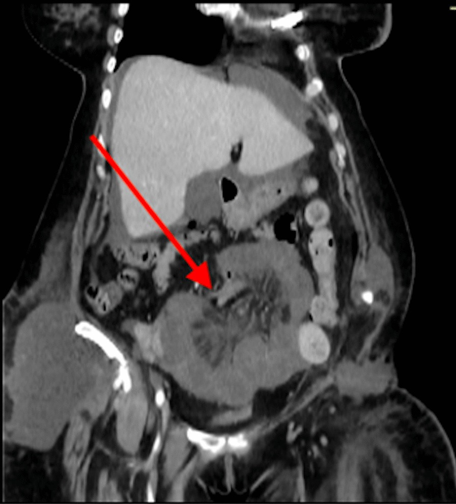Fig. 4