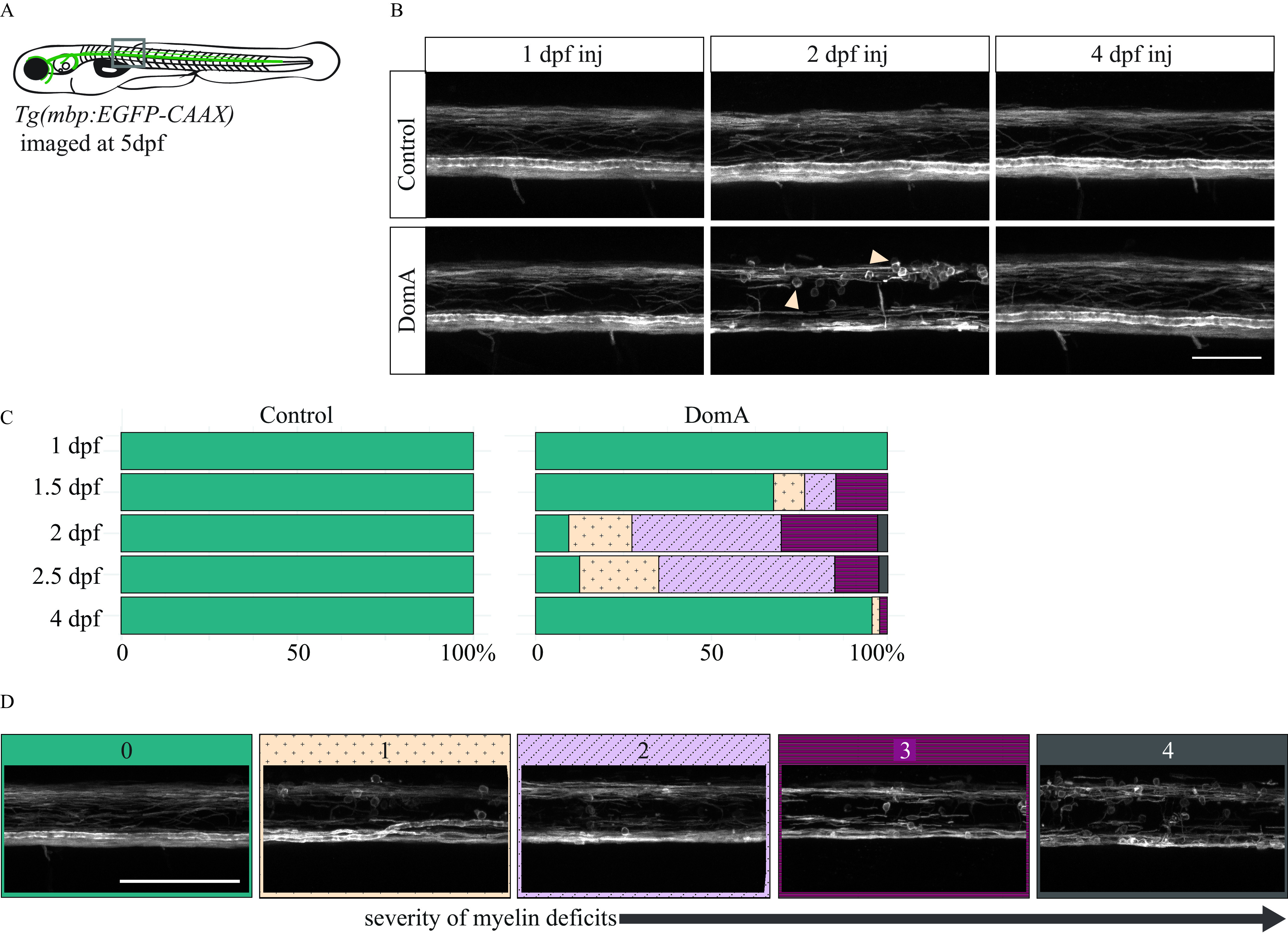 Figure 5A is an illustration of a 5 day postfertilization zebrafish. Green lines are drawn by the brain and along the spinal cord to represent the expression pattern of the transgene. A gray box is placed on the upper spinal cord. Below the illustration is the label “Tg(mbp:EGFP-CAAX)” or transgenic zebrafish with myelin basic protein promotor driving EGFP expression with a CAAX motif, images at 5 days post fertilization. Figure 5B depicts images of myelin sheath structures of control fish and fish exposed to domoic acid at 1, 2, and 4 days postfertilization. Figure 5C is a set of two stacked bar graphs titled control and domoic acid showing the distribution of myelin phenotypes from injects that occurred during discrete developments times, namely, 1, 1.5, 2, 2.5, and 4 days postfertilization. The bar graphs are flipped so that the horizontal axis shows the distribution of myelin in different color and pattern blocks between 0 and 100 percent in increments of 50 percent. Figure 5D depicts confocal microscopy images of different myelin phenotypes that were observed. They are classified and assigned a category based on the severity.