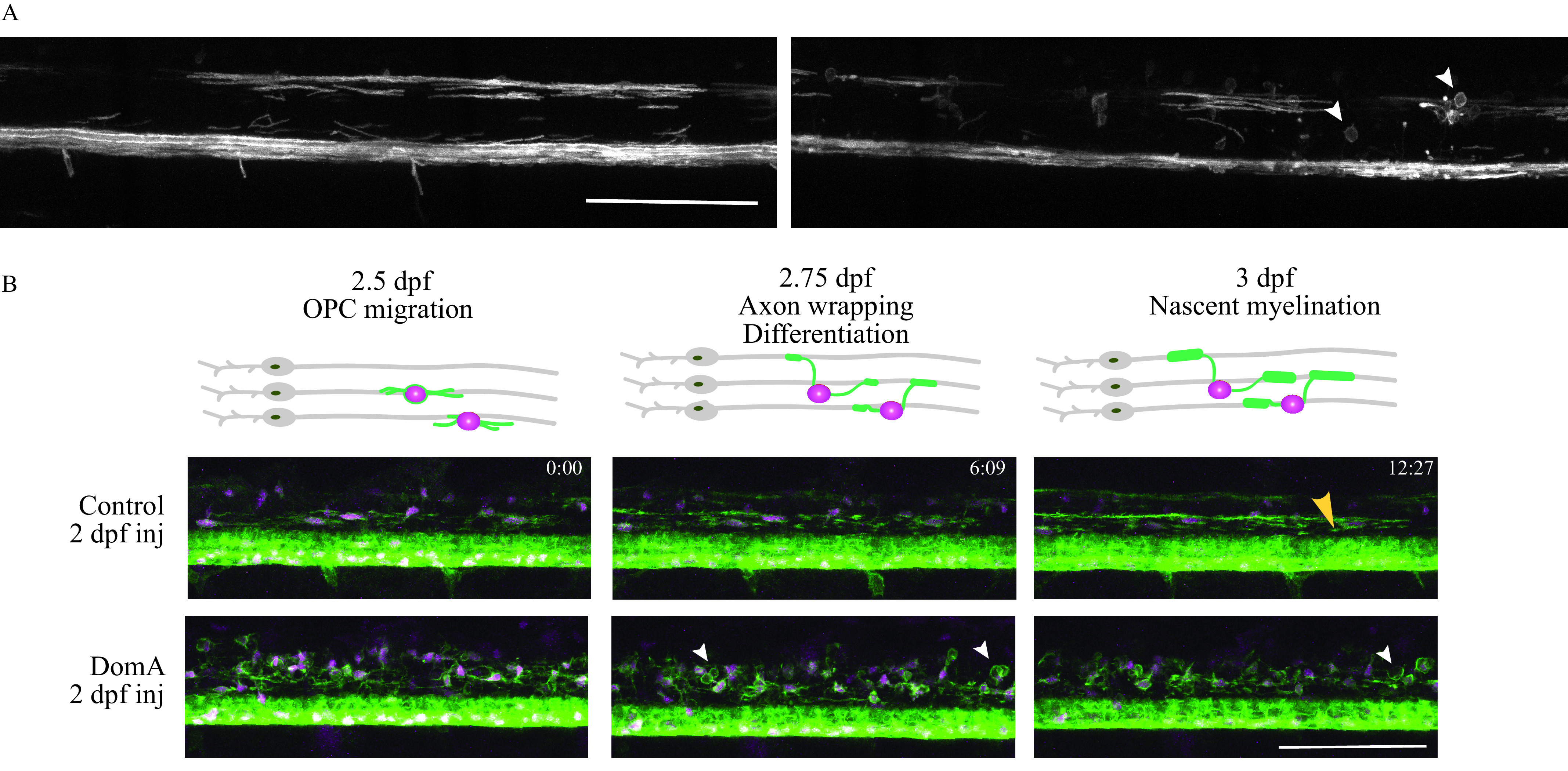 Figure 8A shows confocal images of spinal cords of transgenic zebrafish with myelin basic protein promotor driving EGFP expression with a CAAX motif. The left image is a control fish injected with saline vehicle at 2 postfertilization then imaged at 3 postfertilization. The right image is a fish injected with 0.14 ng of domoic acid at 2 postfertilization then imaged at 3 postfertilization. Figure 8B shows stills from a time-lapse at three developmental time points, namely, 2.5, 2.75, and 3 days postfertilization. Above each image, there is a schematic of the developmental processes that occur during the time. The label 2.5 days postfertilization shows a schematic of oligodendrocyte progenitor cell migration. The label 2.75 days post fertilization shows a schematic of axon wrapping and differentiation. The label 3 days post fertilization shows nascent myelination.