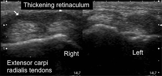 Figure 14