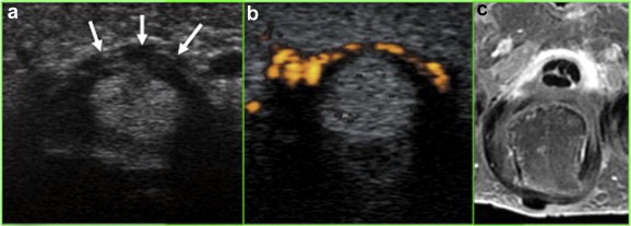 Figure 3