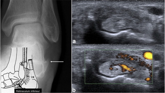 Figure 16