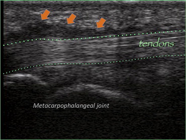 Figure 12