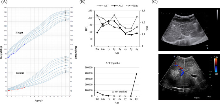 FIGURE 2