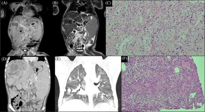 FIGURE 1