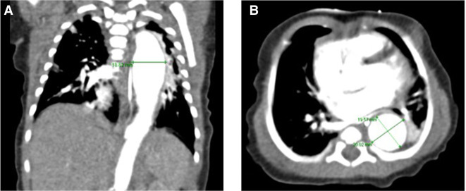 Figure 2.