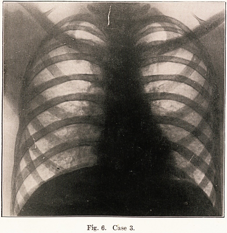 Fig. 6. Case 3.