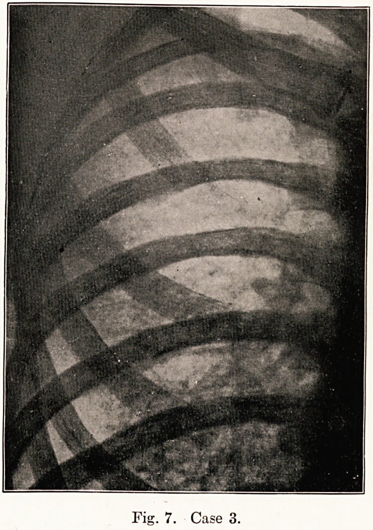 Fig. 7. Case 3.