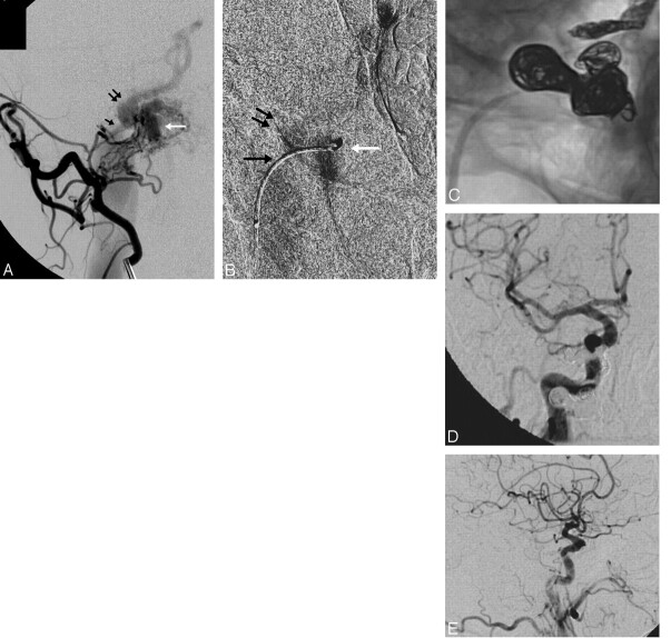 Fig 2.