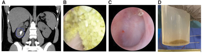 FIG. 2.