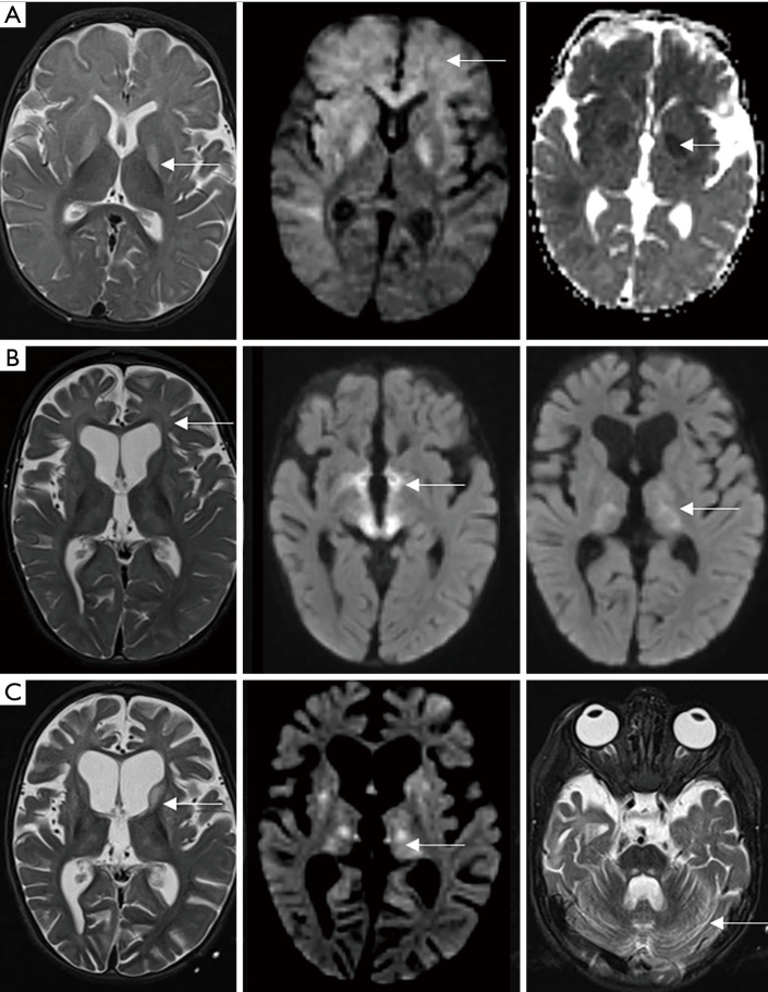 Figure 18