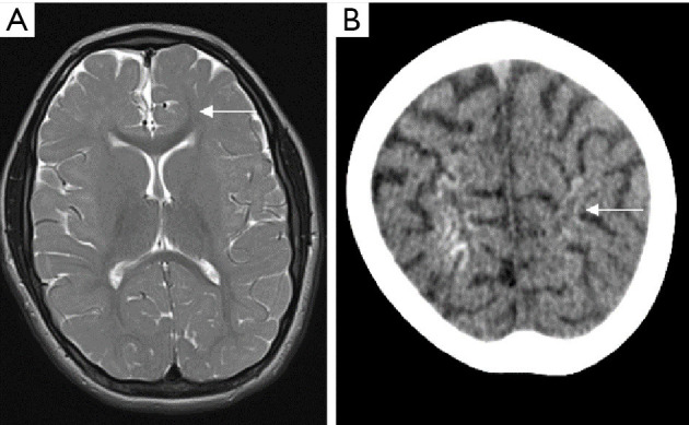 Figure 19