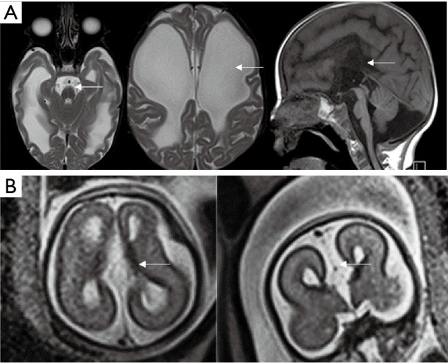 Figure 17