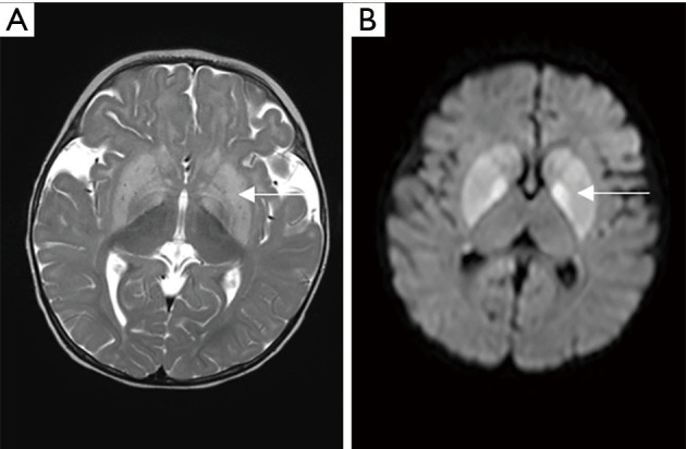 Figure 16