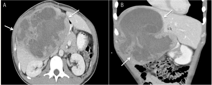 Figure 2 A & B: