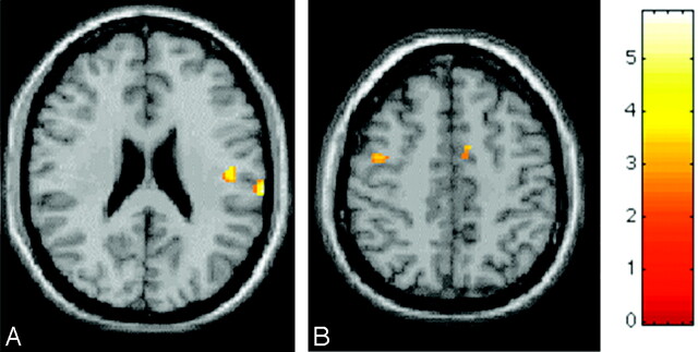 Fig 2.