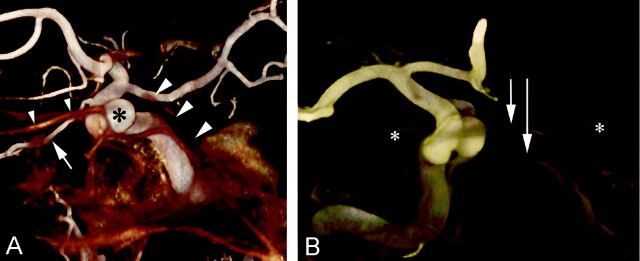 Fig 3.