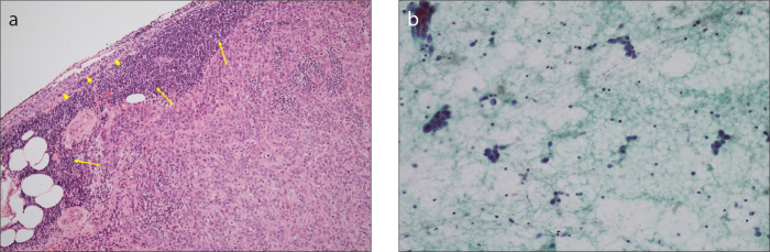 Figure 2. a, b