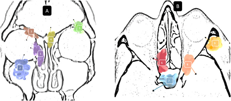 Fig. 1