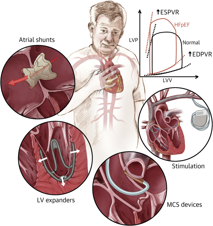 Central Illustration