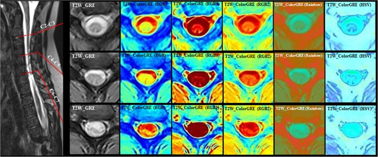 Fig. 6