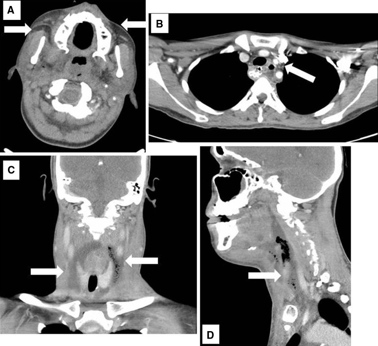 Fig. 2