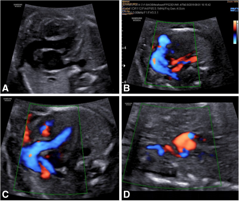 Fig. 3