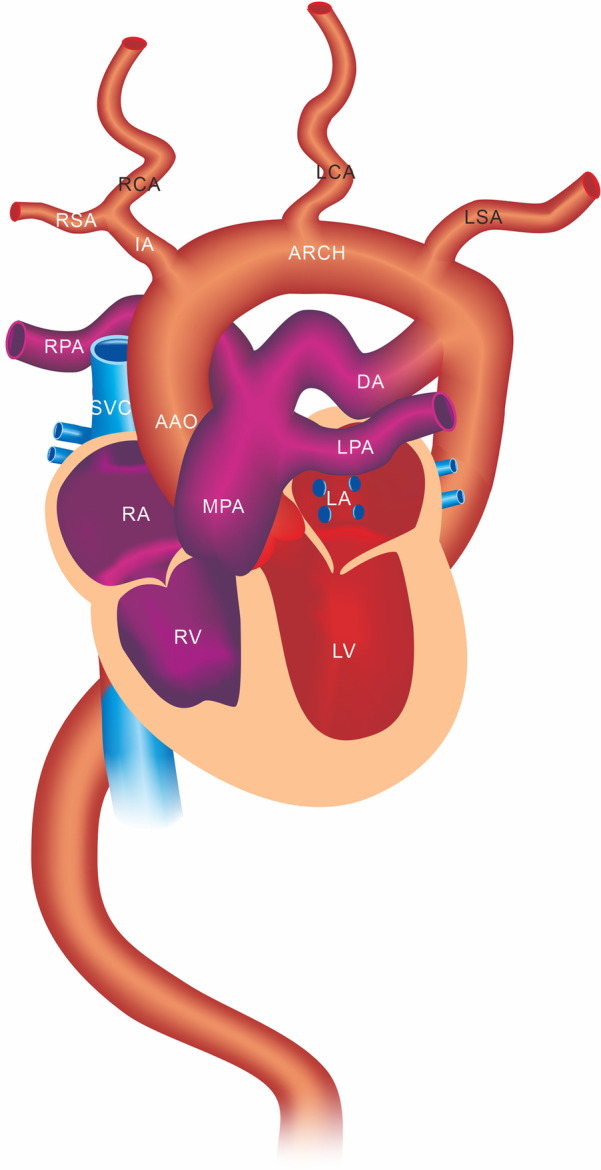 Fig. 4