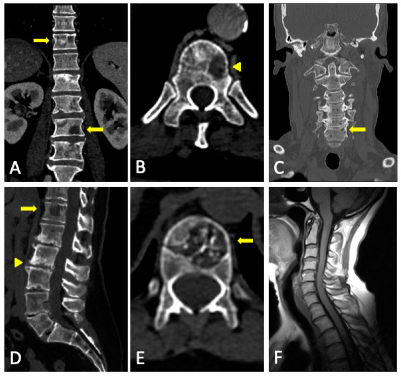 Figure 13