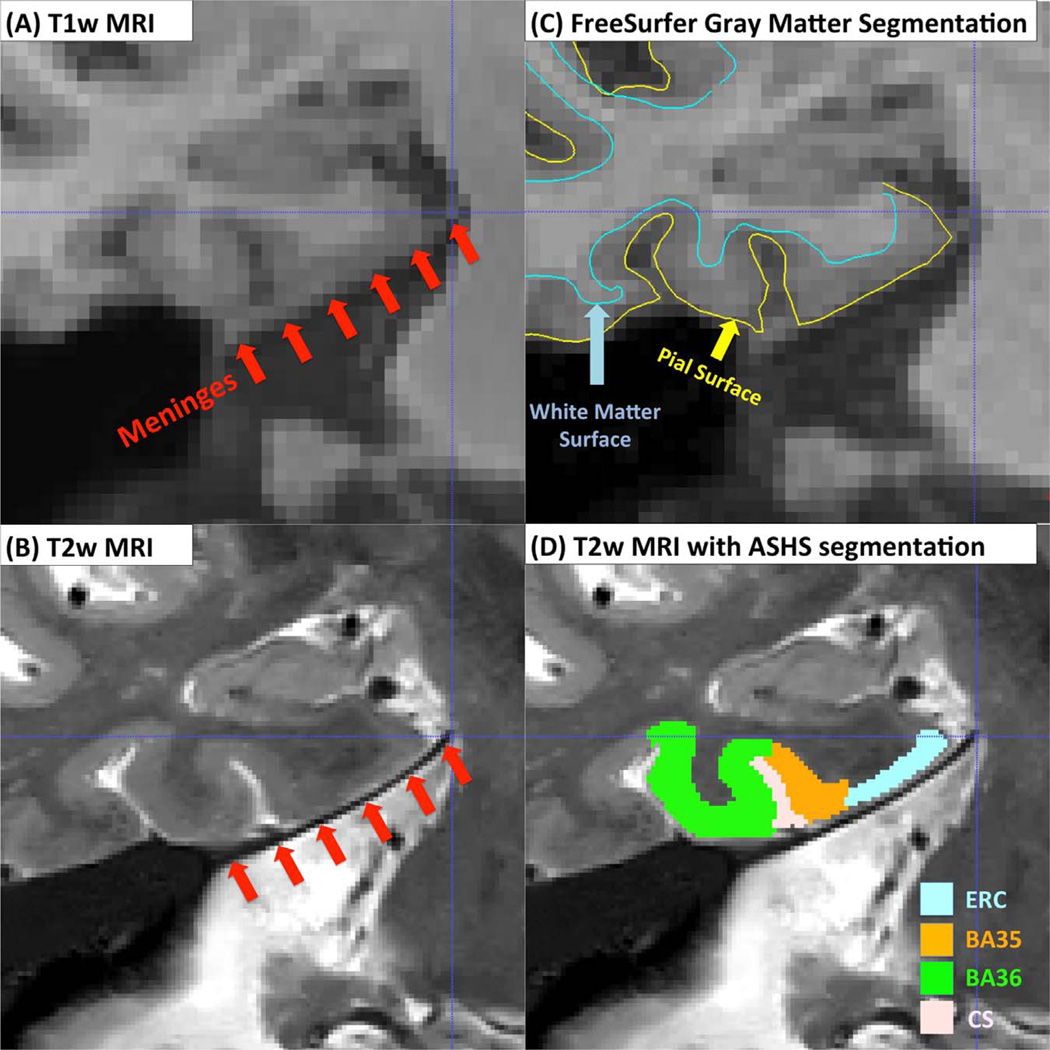 Fig. 14