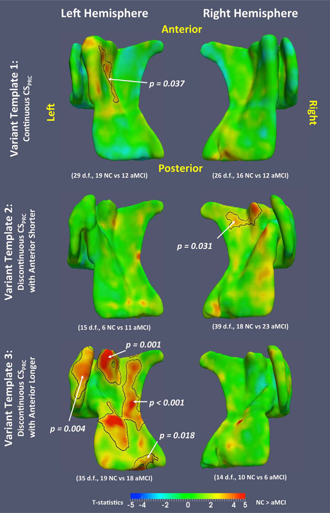 Fig. 12