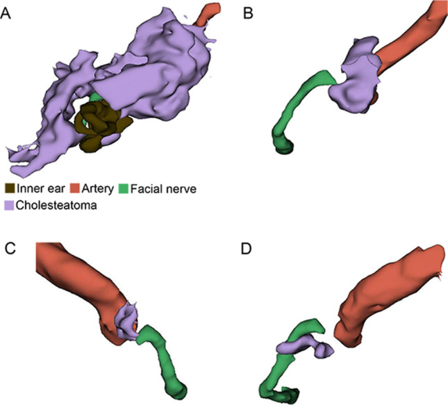 Fig. 4