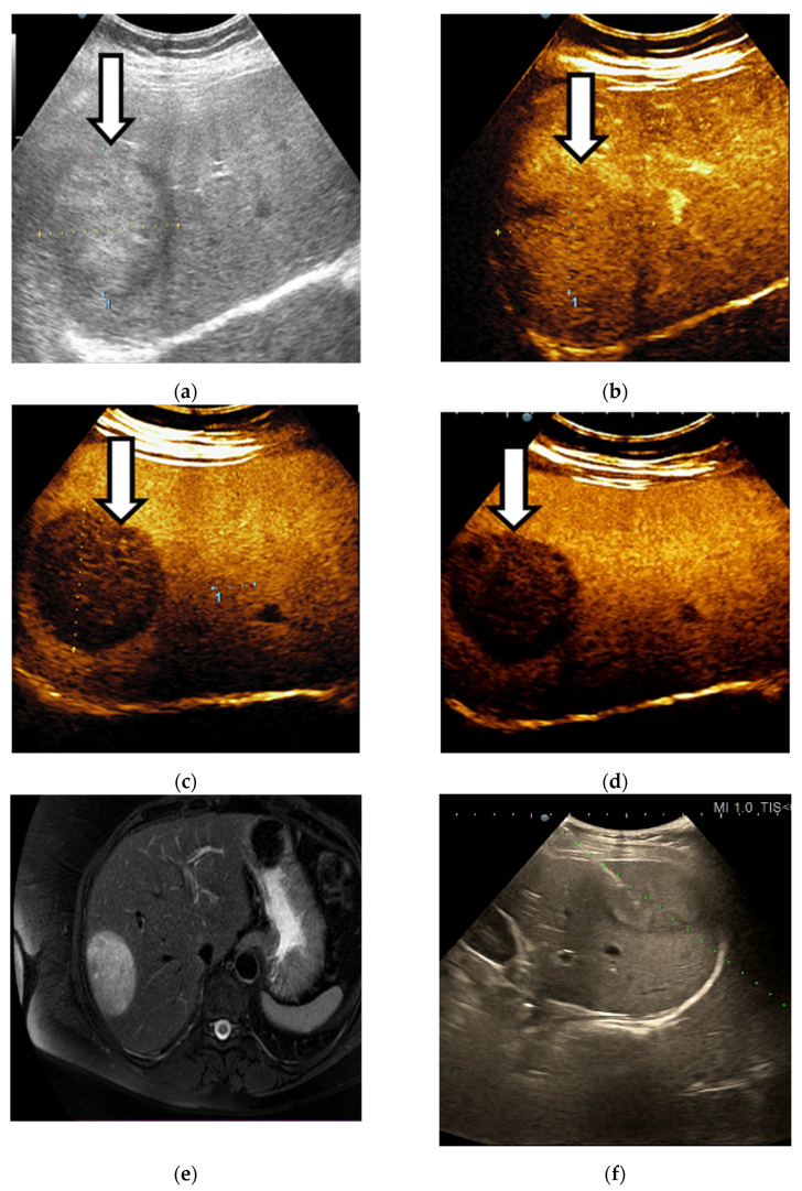 Figure 9