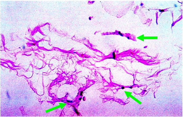 Figure 23 