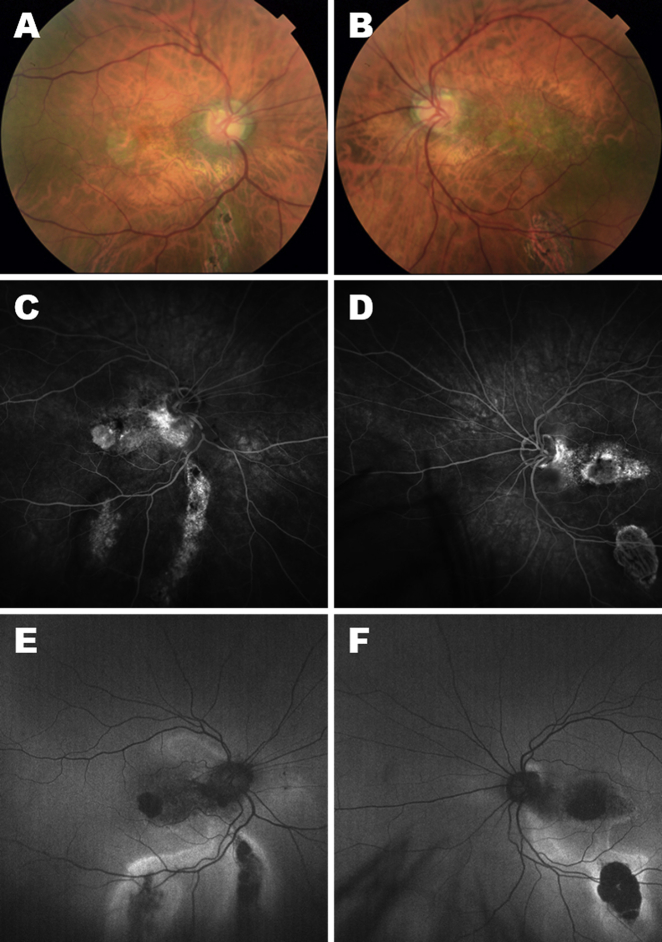 Fig. 1