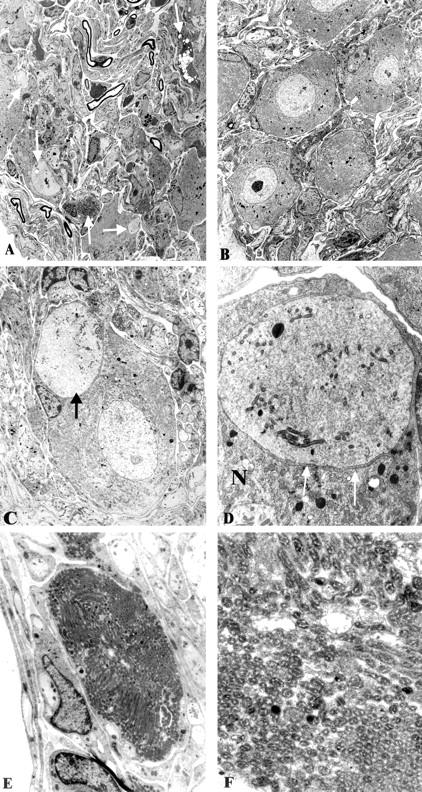 Figure 2A.