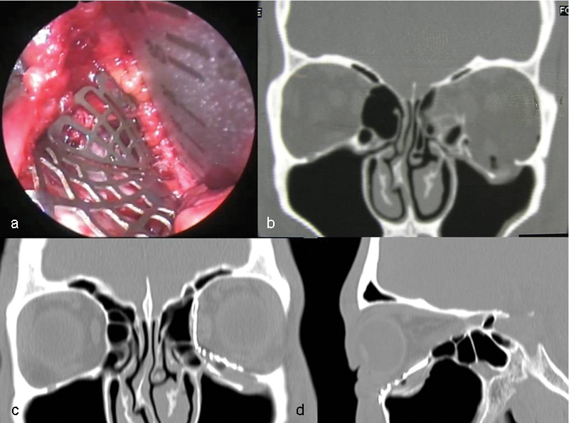 Fig. 5