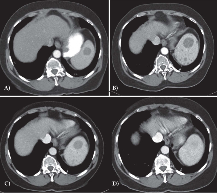 Fig. 1.