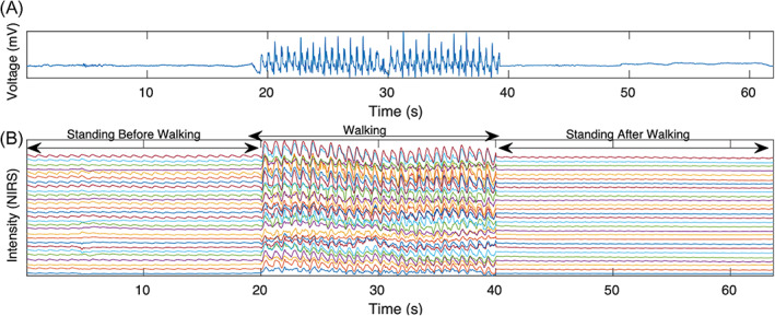 FIGURE 3