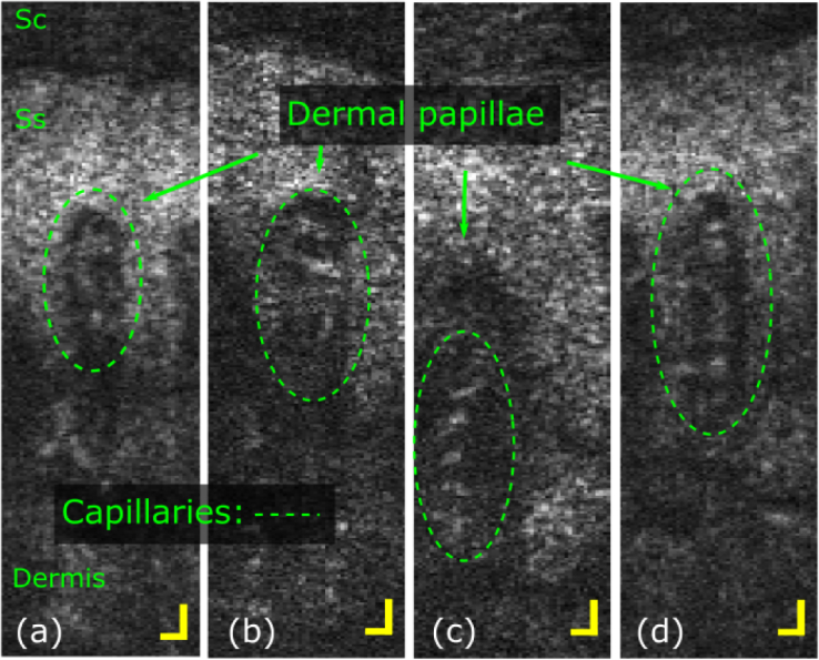 Fig. 11