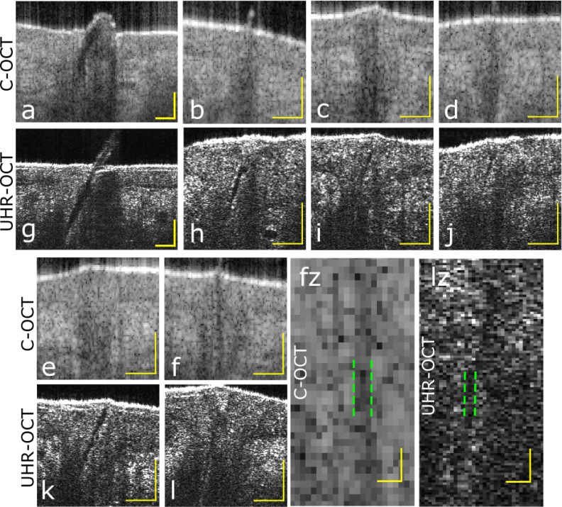 Fig. 12