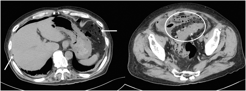 Fig. 2