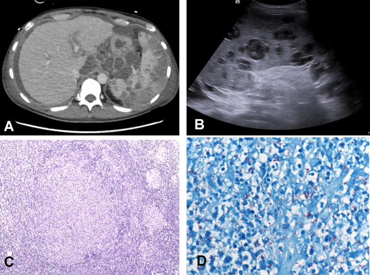 Fig. 1