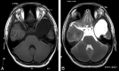 Fig 3.