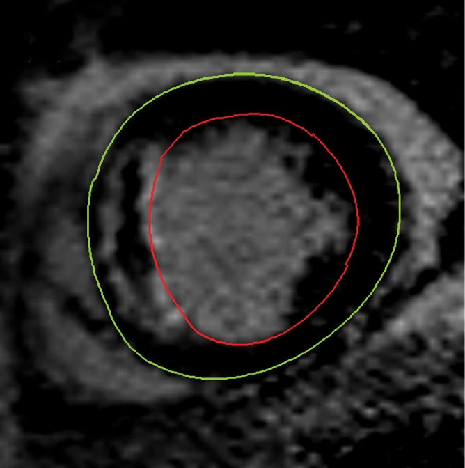 Figure 1a: