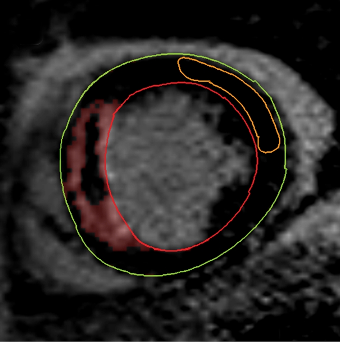 Figure 1b: