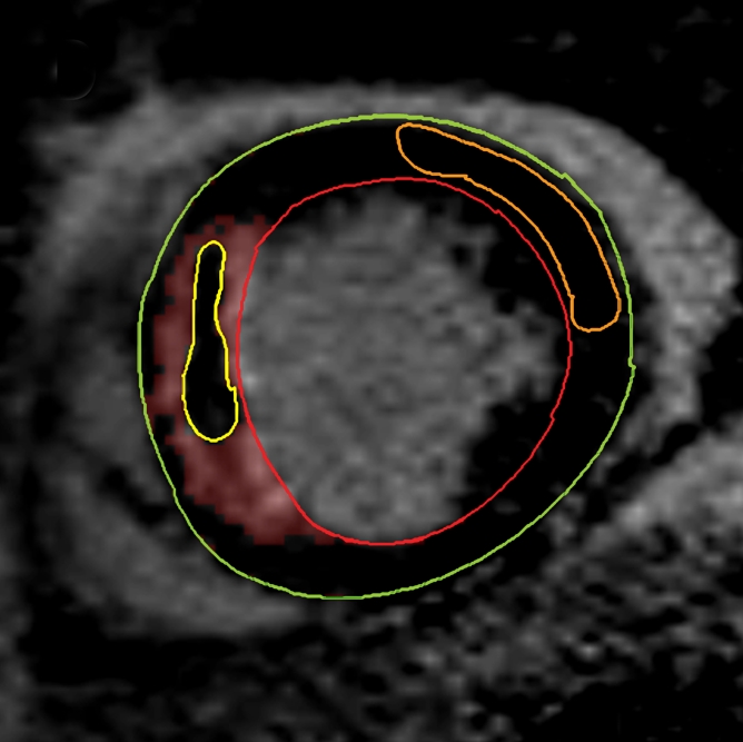 Figure 1d: