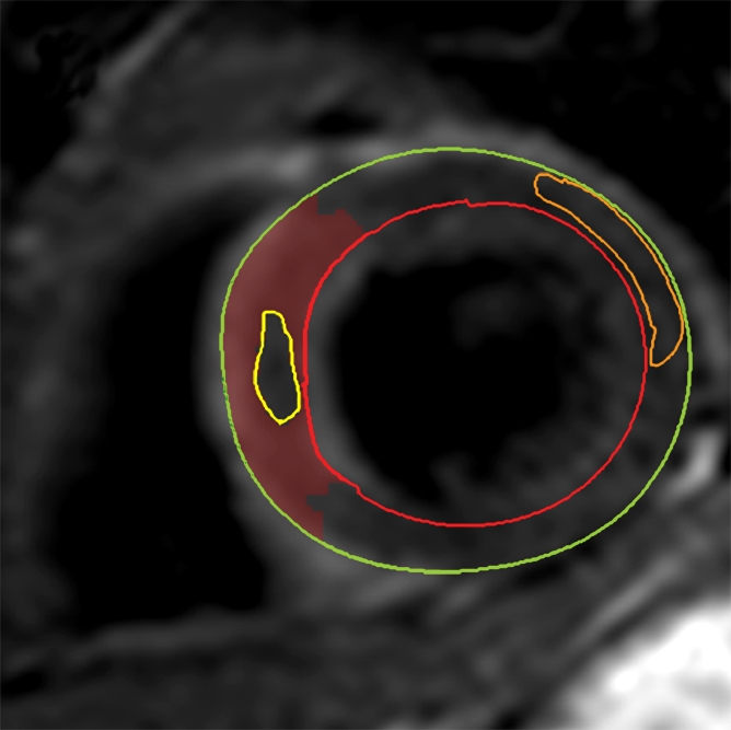 Figure 2d: