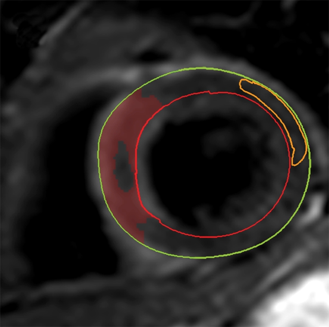 Figure 2b: