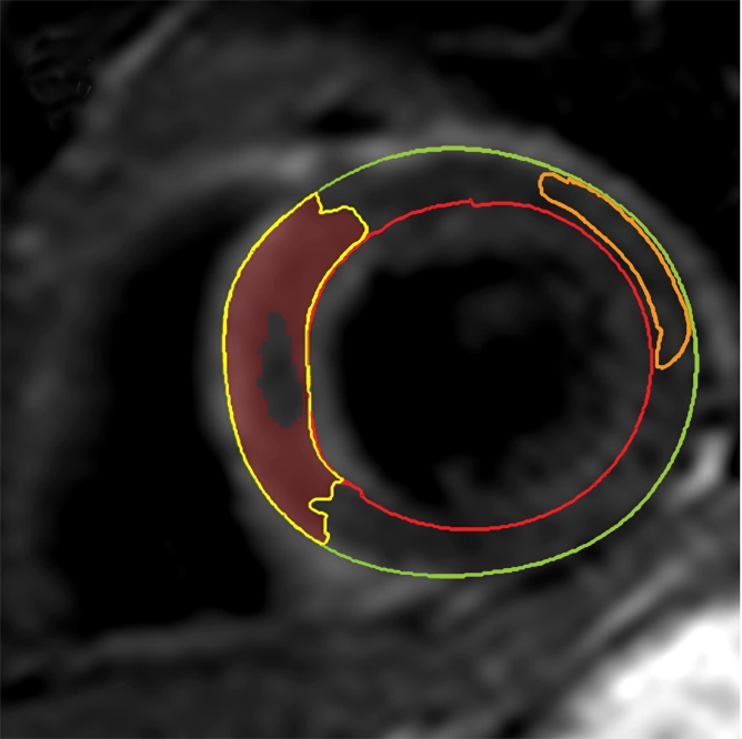 Figure 2c: